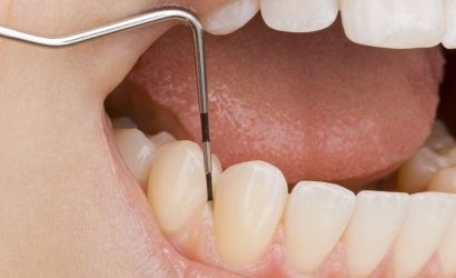 Zahnarzt Grossenhain Parodontalbehandlung